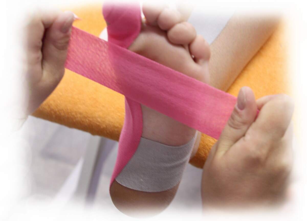 Kinesiotaping I, II a Lymfotaping