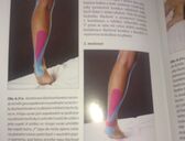 Kinesiotaping a Lymfotaping - Brno - #2