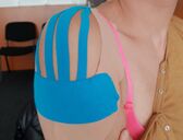 Kinesiotaping a Lymfotaping - Brno - #5