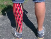 Kinesiotaping I, II a Lymfotaping