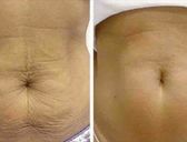 Masáž Galvanic Spa Body - NOVINKA