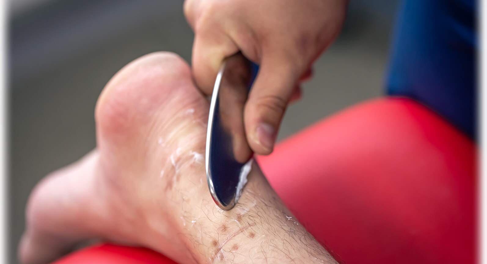 IASTM - mobilizace měkkých tkání pomocí instrumentů