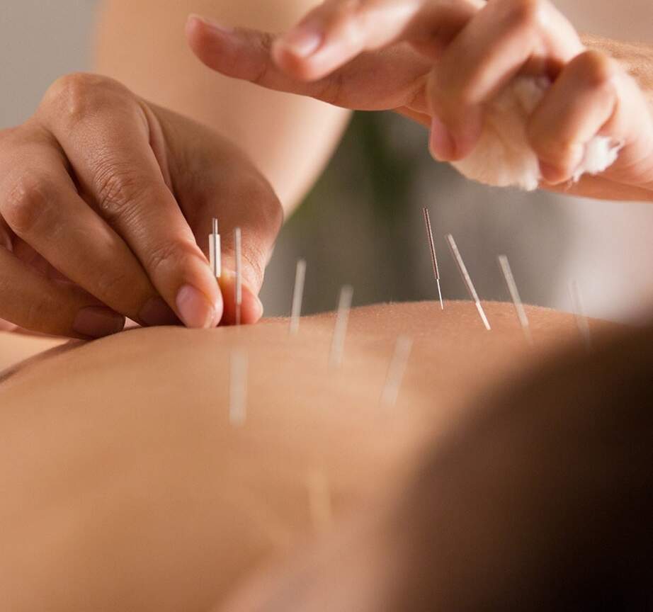 Základy akupunktury - metodou TČM